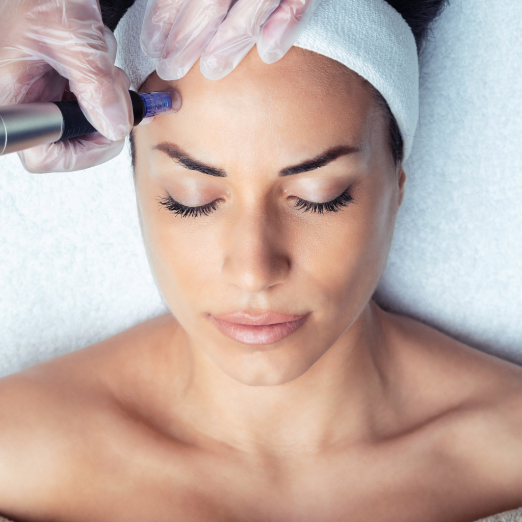 Microneedling​