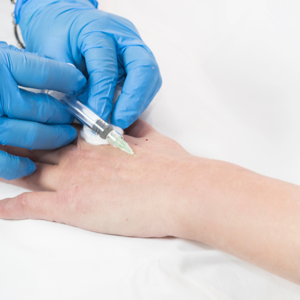 Hand rejuvenation​