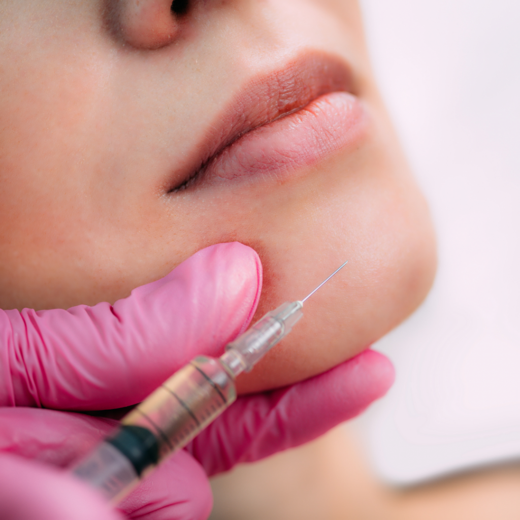 Chin filler