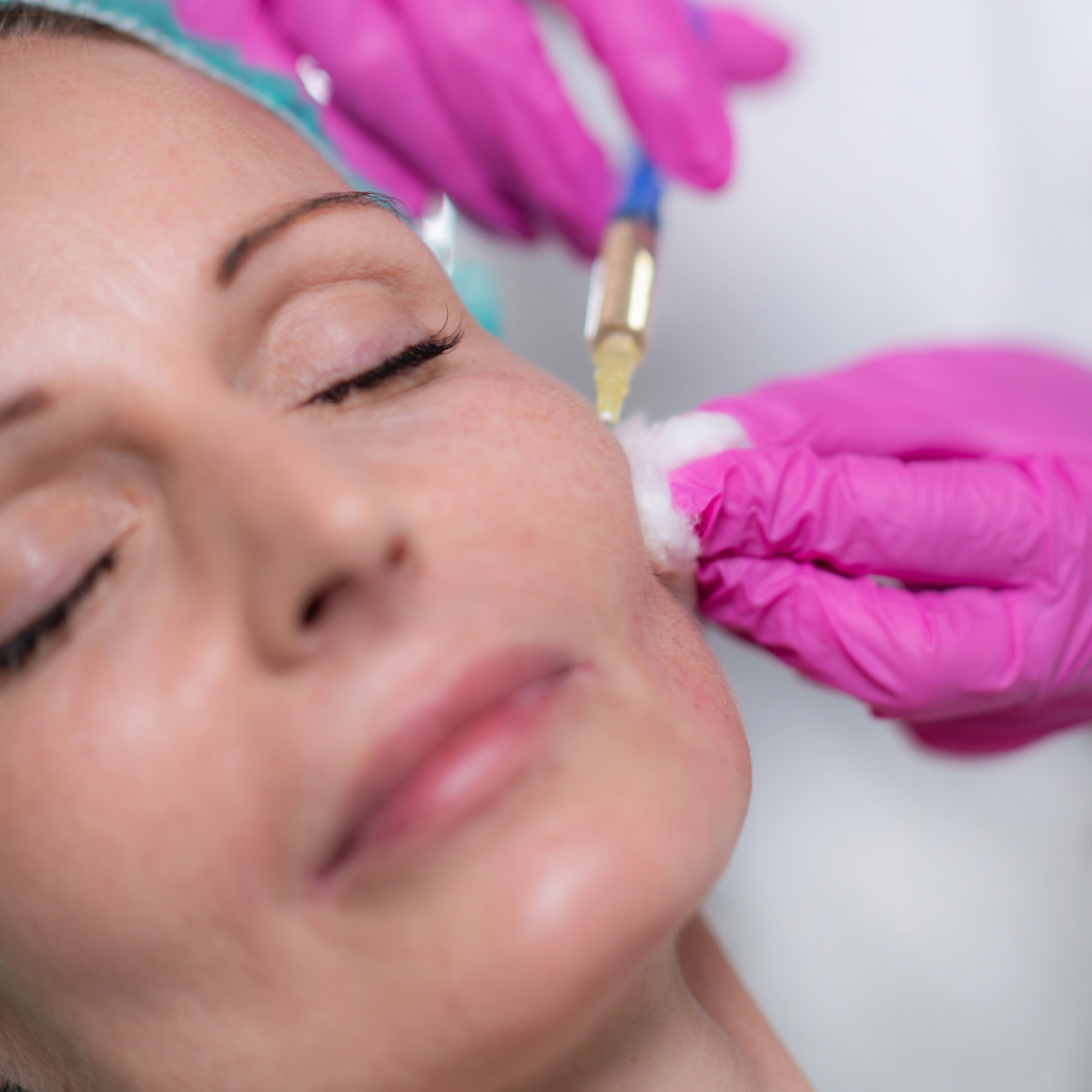 Cheeks Filler